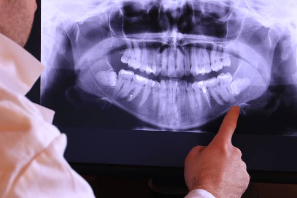 Best Emergency Broken Tooth Repair in Green Island, NY