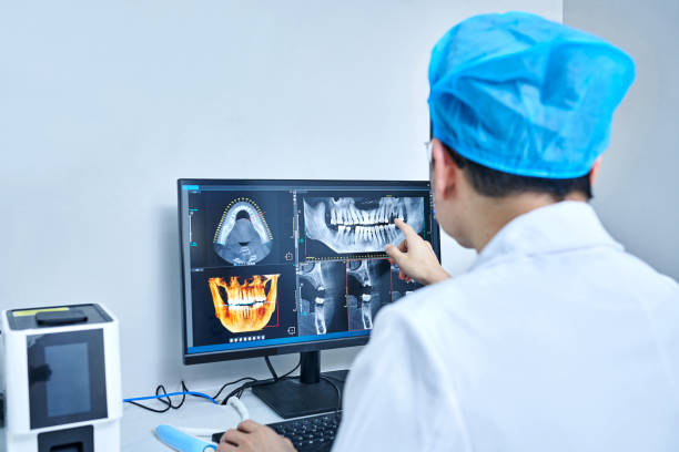 Best Emergency Wisdom Teeth Removal in Green Island, NY