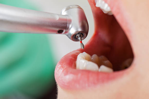 Best Emergency Treatment for Toothache in Green Island, NY